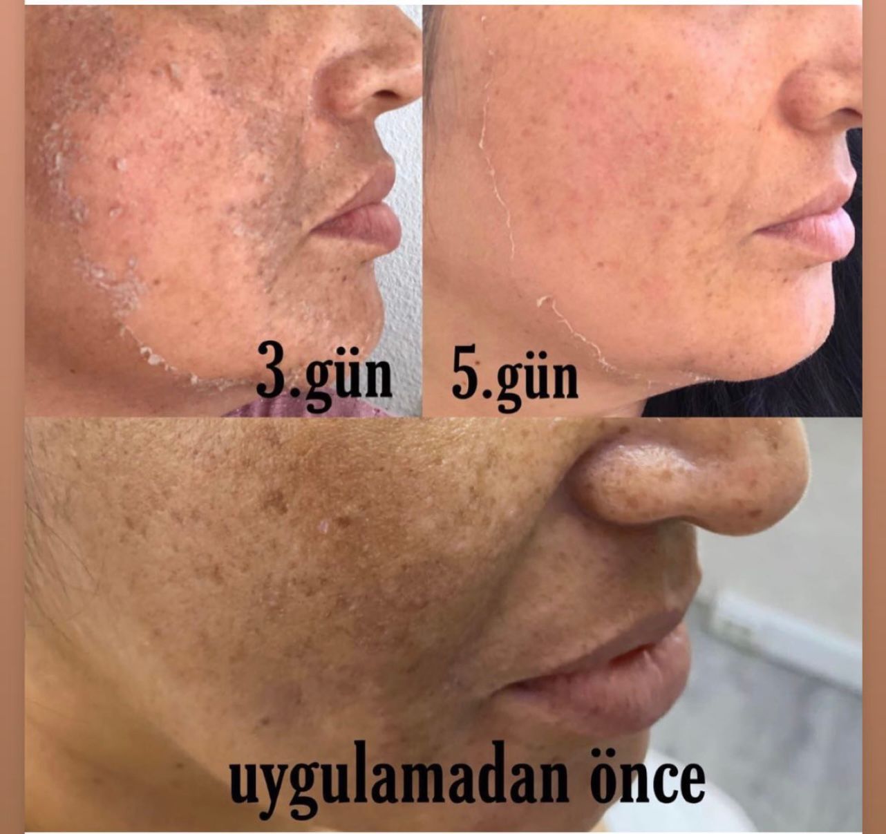 Decaar kullanıcı yorumları